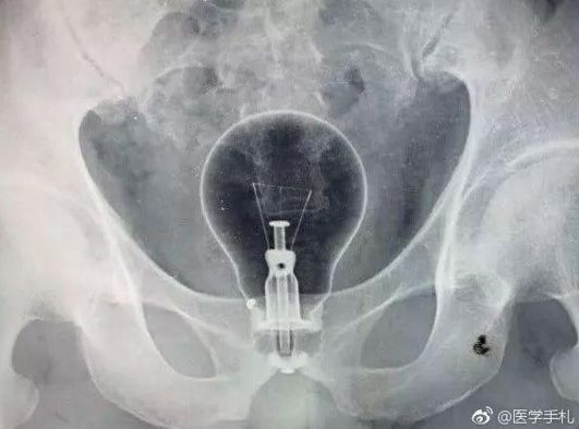 手淫后运动_手淫后运动_手淫后运动